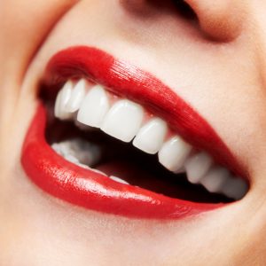 Woman smile. Teeth whitening. Dental care.